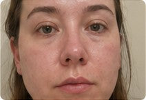 Front-facing customer result with realistic skin texture