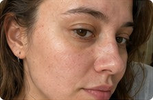 Customer result showing natural pores and skin texture