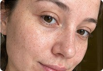 Close-up customer result with natural freckles
