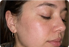 Side-profile customer result showing natural skin