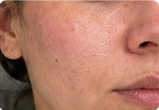 Close-up customer result with realistic skin texture