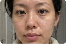 Front-facing customer result in natural lighting