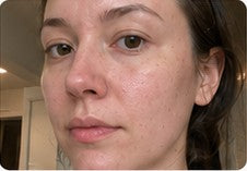 Front-facing customer result with ordinary skin texture